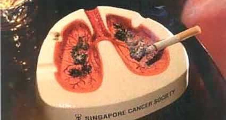 Ectopic ATCH Syndrome often develops as a secondary condition to lung cancer.