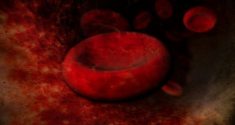 Os exames de sangue podem apresentar anemia, que é uma baixa contagem de células vermelhas do sangue