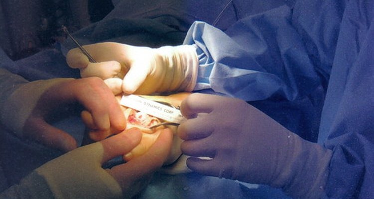 A strangulated hiatal hernia is likely to require surgery.