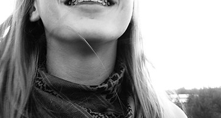 Child with braces