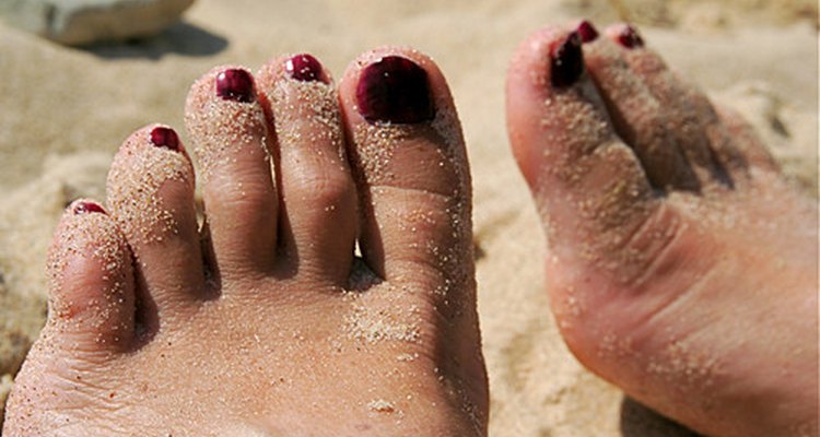 As verrugas plantares ocorrem nos pés