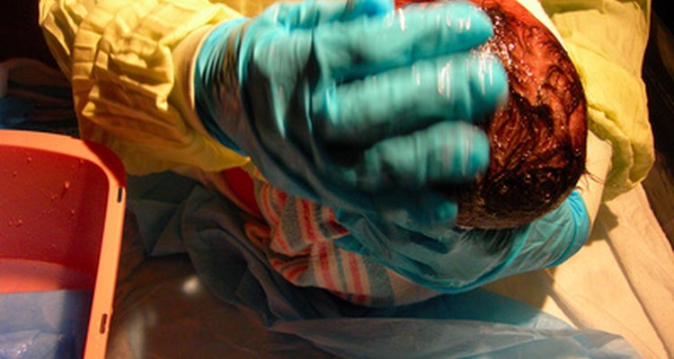 Midwives support mothers before, during and after childbirth.