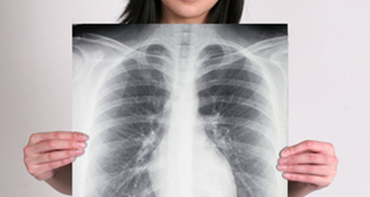 Um raio-x de tórax pode mostrar a sombra cardíaca
