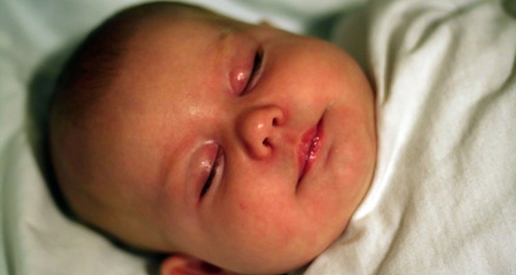 Bebê com olhos inchados