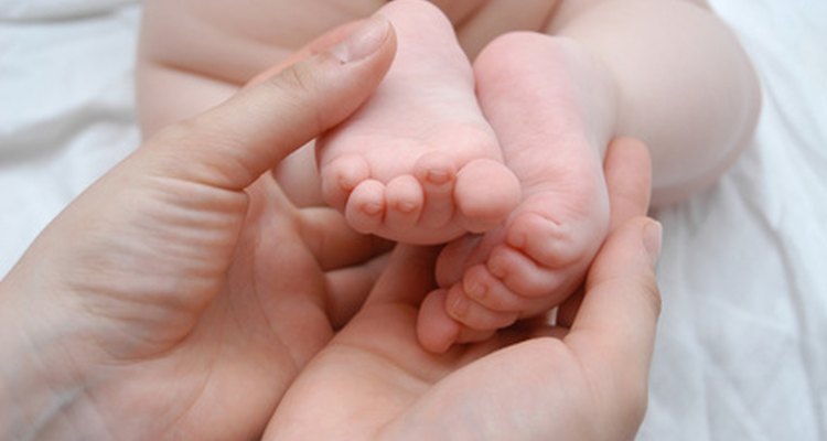 Los bebés prematuros tienen muchas características que los diferencian de los bebés de término completo.