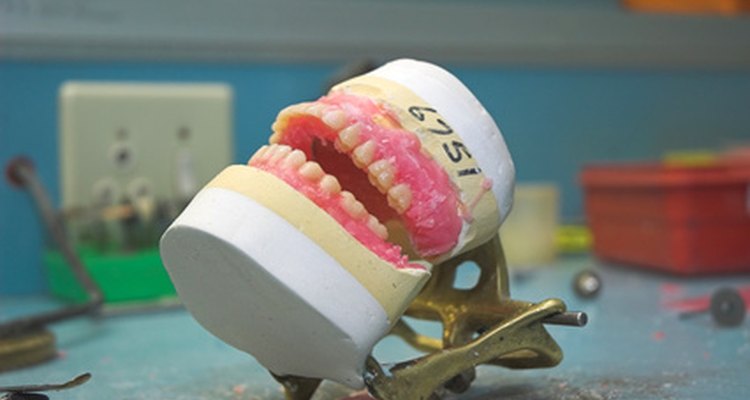 Para manter a dentadura no lugar, pode ser colocado um adesivo na parte de dentro dela