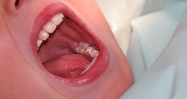 Los dolores de dientes no sólo se producen cuando se tiene problemas en ellos.