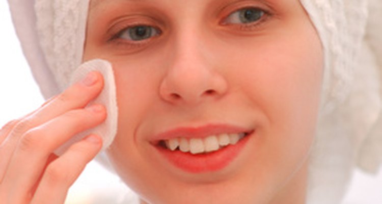 Squeezing inflected blackheads can lead to bruised skin.