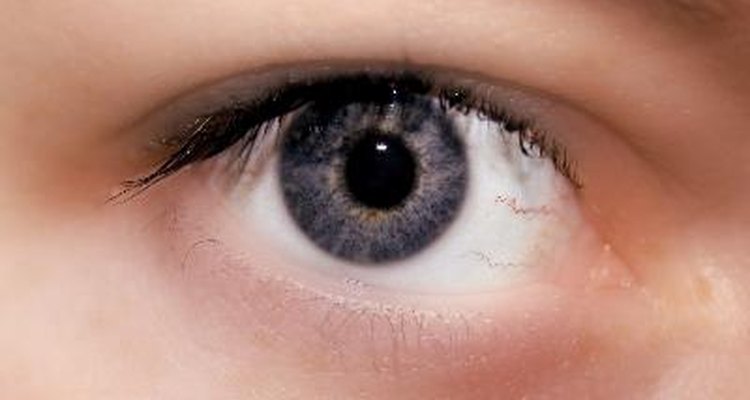 Saiba o que pode causar a mudança na cor dos seus olhos