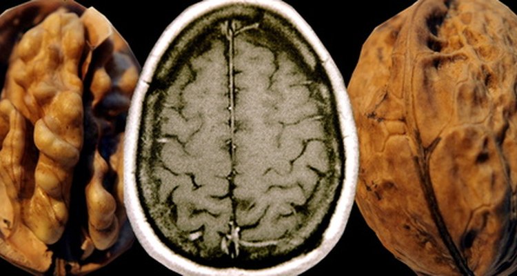 Parts of the brain can degrade with age. Playing brain games can decrease this.