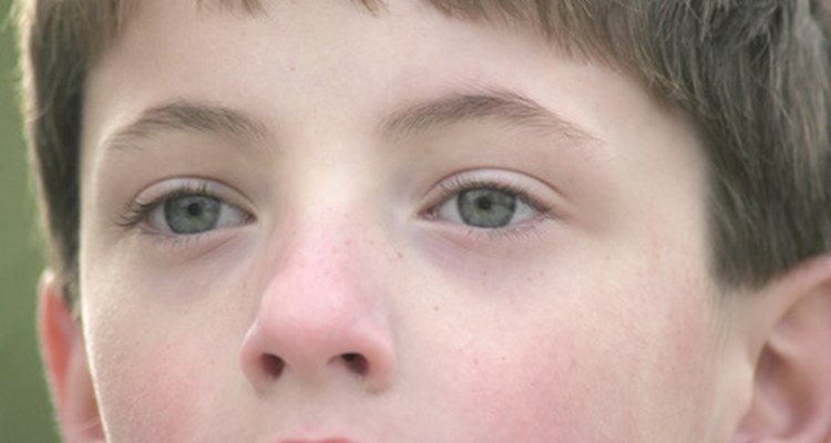 Consigue un diagnóstico para los ojos hinchados de tu hijo.