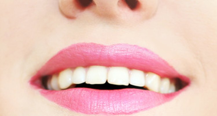La esmaltoplastia se usa para dar forma a los dientes, haciéndolos más pequeños y suavizando los bordes no uniformes.
