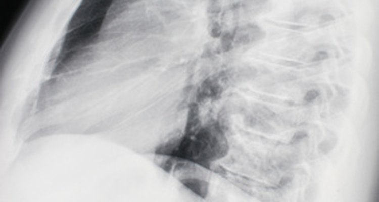 Tu veterinario puede ser capaz de ver un tumor de hígado mediante los rayos X.