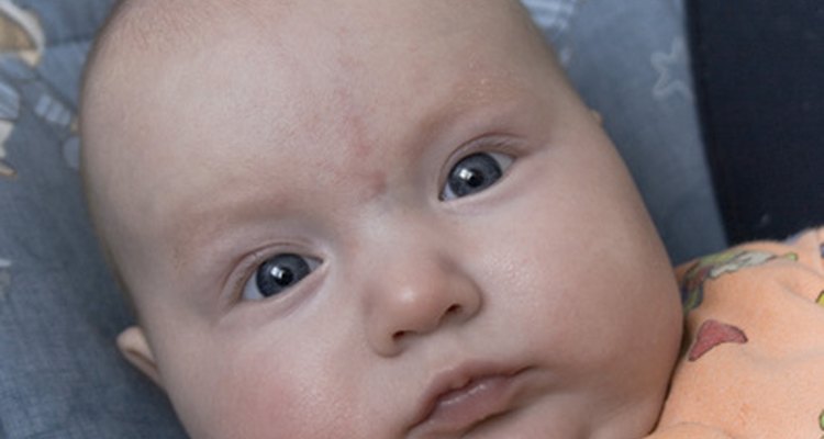 Um bebê pode ter um caroço na cabeça, consequência de efeitos comuns de um parto