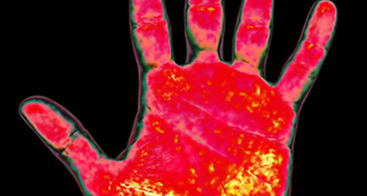 Thermography can show areas of injury, but there are some disadvantages.