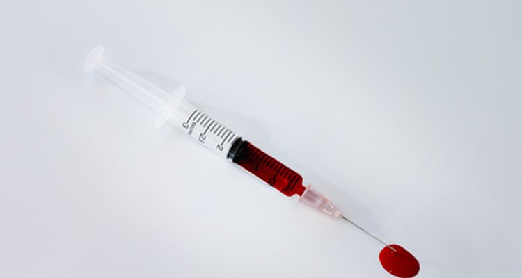 Uma amostra de sangue inclui tanto os glóbulos brancos quanto os vermelhos