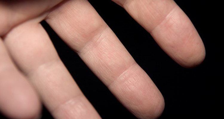 La descamación de la piel de los dedos puede tener muchas causas.