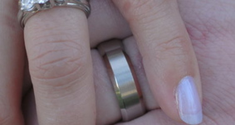 Check your wedding ring for rhodium plating.