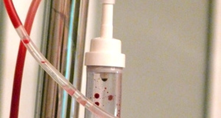 Abnormally shaped blood cells can endanger your health.