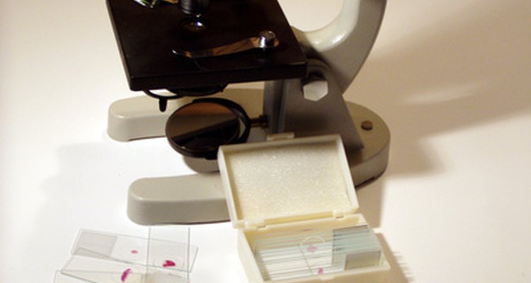Las infecciones por candidiasis se diagnostican a través de la revisión en el microscopio.