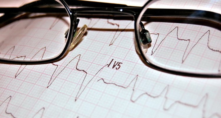 La prueba ACLS enfatiza los trazados del corazón.