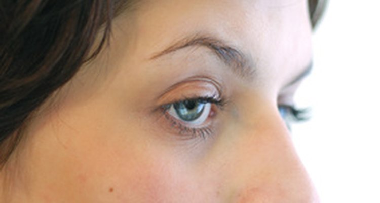 O sulfametoxazol com trimetoprim é um tratamento efetivo contra a acne