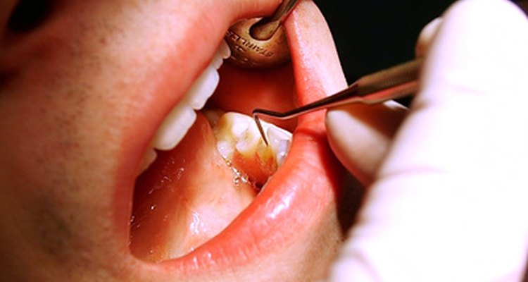 Los cirujanos dentistas llevan a cabo procedimientos simples y complejos de cirugía.