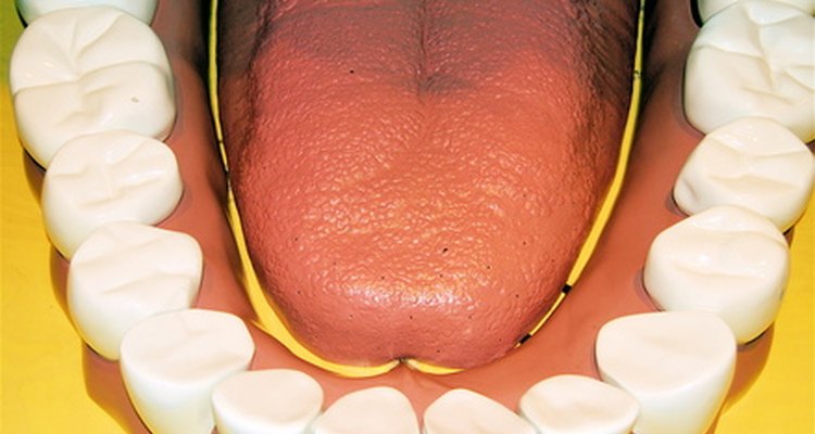 La extracción de las muelas de juicio limita el riesgo de infecciones de los dientes y de las las encías.