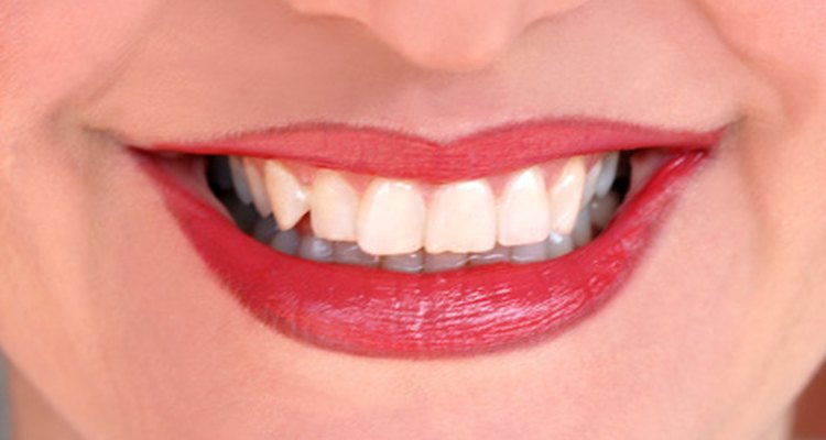 Arreglar un diente astillado de inmediato salvará a tu sonrisa.