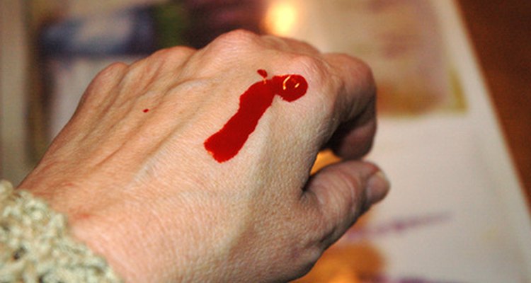 As plaquetas são essenciais para conter a perda de sangue dos ferimentos
