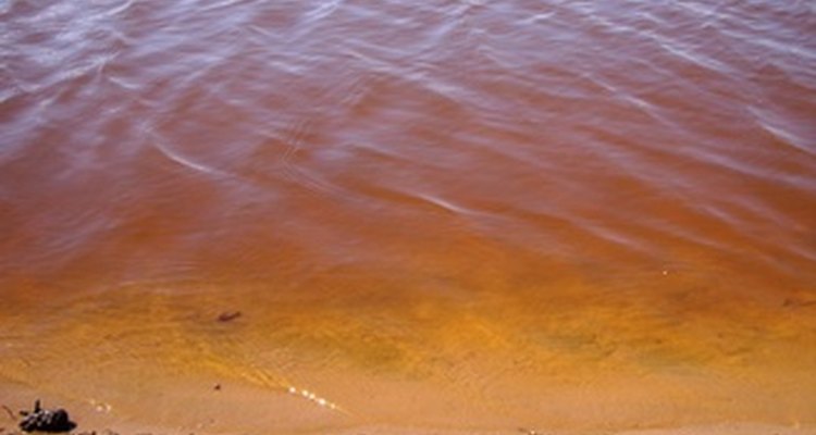 Contaminated water can transmit parasites