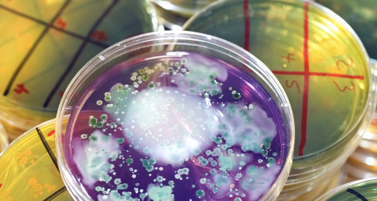 Algunos aditivos causan que el agar cambie de color en respuesta a ciertos tipos de crecimiento bacteriano.