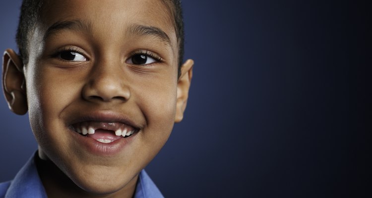 Los dientes de leche deben salir para hacer espacio a los dientes permanentes.