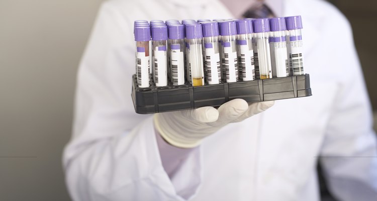 Total and direct bilirubin is directly measured in the serum, but indirect bilirubin is calculated.