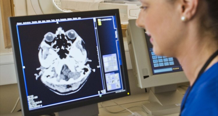 A tomografia destaca lesões e tumores no cérebro