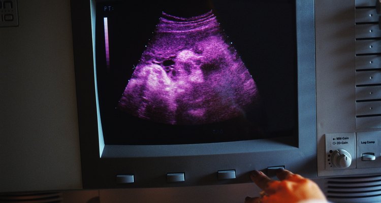 Técnico em ultrassonografia apontando para a tela