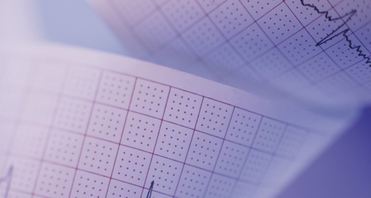 how-to-calculate-ventricular-rate