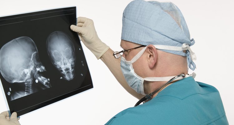 Los neurocirujanos se especializan en condiciones que afectan al cerebro y a la espina dorsal.