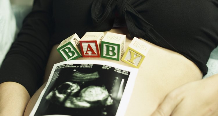 Un ultrasonido fetal es la cosa más cercana a la visualización de tu bebé.
