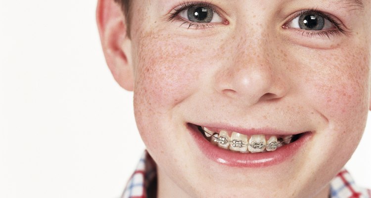 Moving from braces to a retainer can be a difficult adjustment, but there are simple ways to make the transition easier.