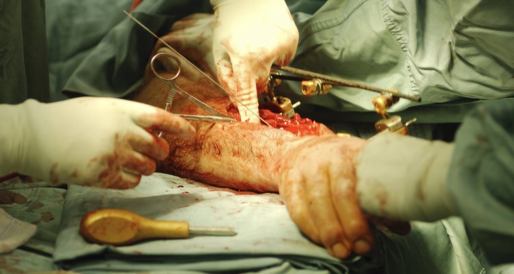 Caerse de una ventana puede dar lugar a fracturas óseas, conmoción cerebral, hematomas y hemorragias, lesiones internas que requieren cirugía, cortes, raspaduras o puntos de sutura.