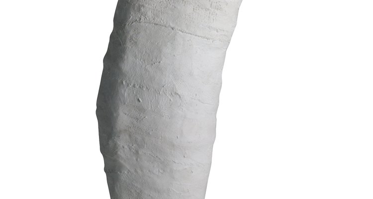 A fake leg cast allows an actor to have a realistic broken leg.
