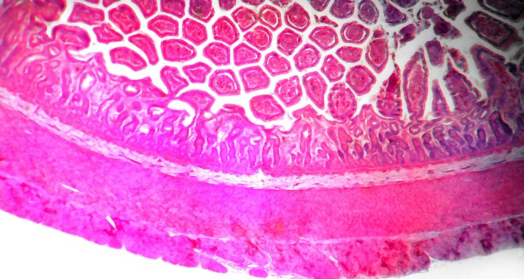 Alguns probióticos ajudam no funcionamento do intestino