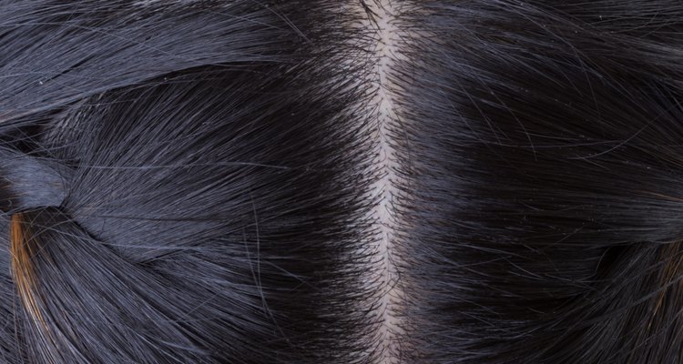 black hair with dandruff on head, close-up image