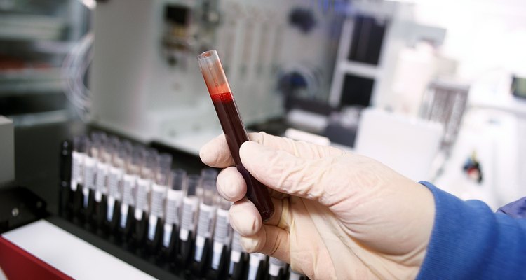 Um simples exame de sangue pode medir os níveis de TGP