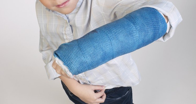 Coloured fibreglass casts are often used for immobilising injured limbs.