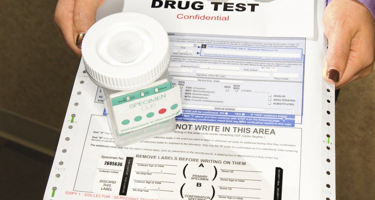 What Are The Causes Of A False Positive Drug Test