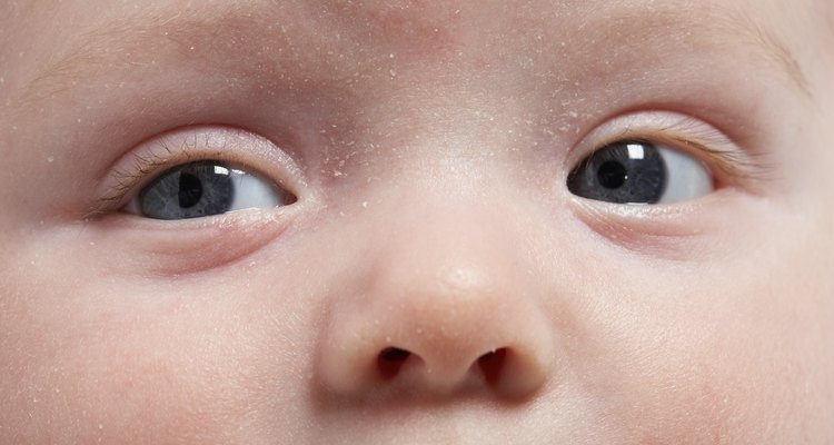 Por lo general es normal que el rostro del bebé no tenga la perfección de una foto.