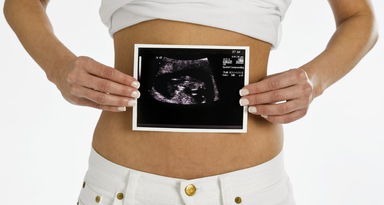 El ultrasonido puede por lo general, aunque no siempre, determinar el número de bebés que llevas.
