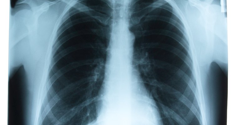 O tórax como é visto em um raio-X, incluindo os pulmões